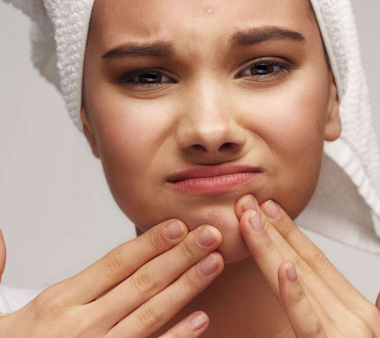 Tout sur l’acné, des réponses, des conseils et des astuces et solutions pour atténuer l’acné 